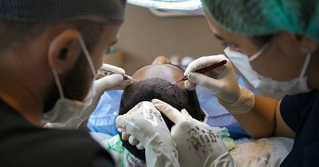 Hårtransplantation i Tyrkiet: Erfaringer fra tidligere patienter